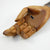 A Rare Victorian Prosthetic Hand by J. Gillingham & Son